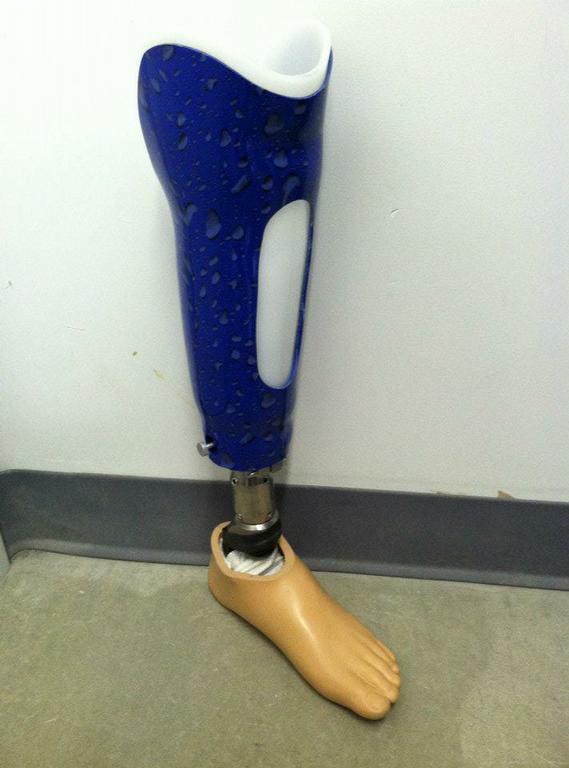 Prosthetic Leg Indianpolis IN Central Brace and Limb from Central